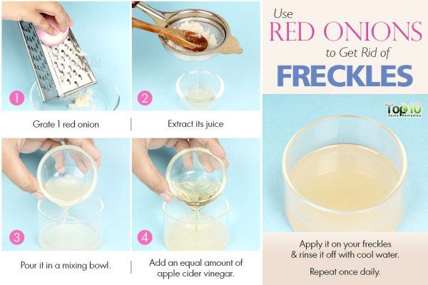 onion juice to get rid of freckles