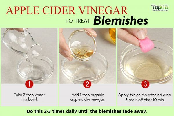 apple cider vinegar remedy for blemishes