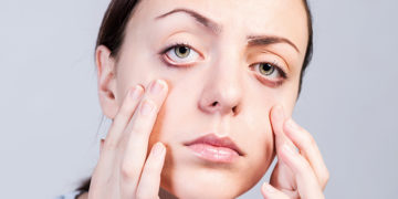 Home remedies for jaundice