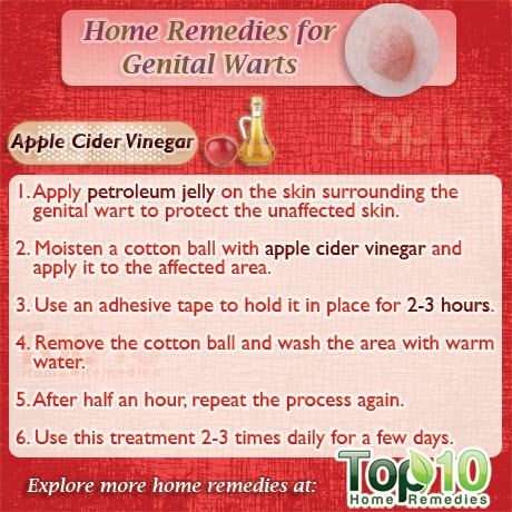 home remedies for genital warts