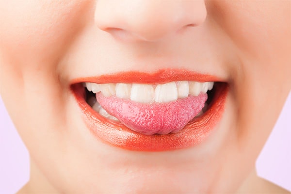 home remedies for tongue blisters