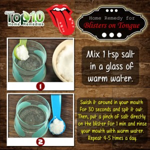 tongue blister home remedy