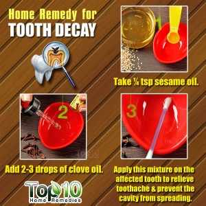 tooth decay home remedy