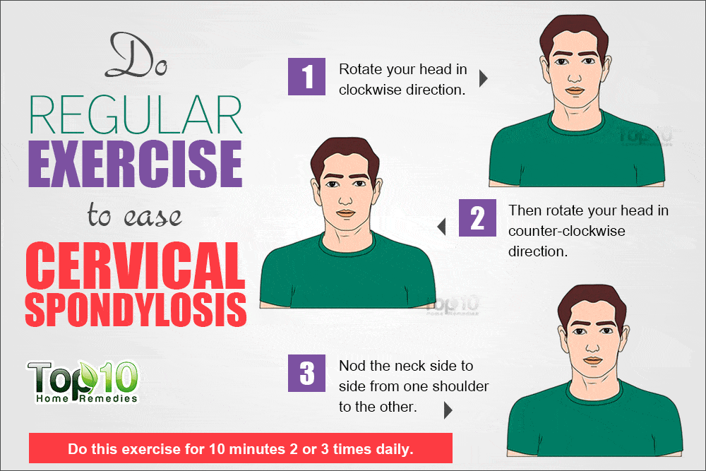 Home Remedies for Cervical Spondylosis | Top 10 Home Remedies