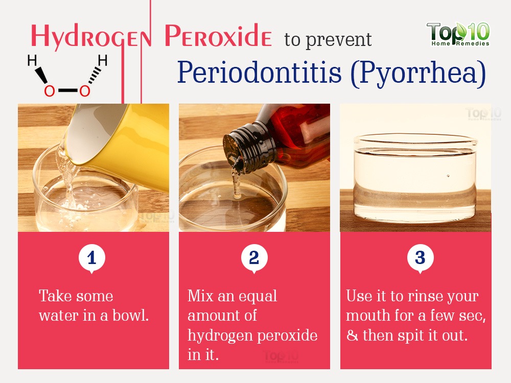 Salt Water Or Hydrogen Peroxide For Gums