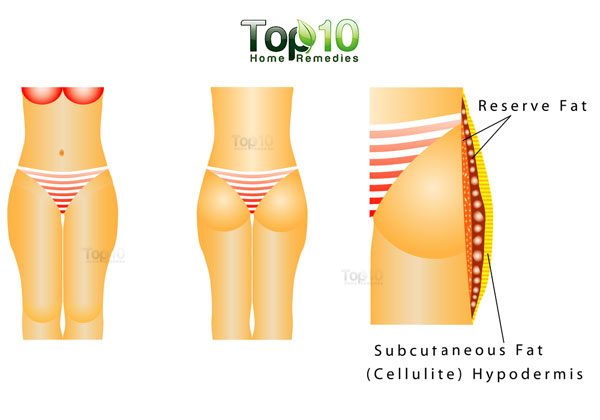 fat on hips and thighs