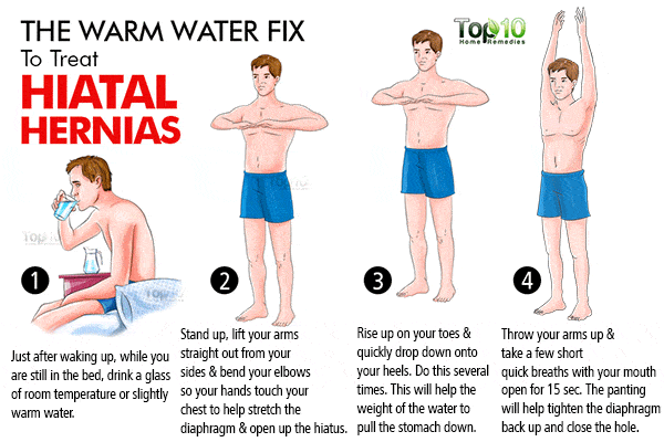 hiatal hernia warm water fix
