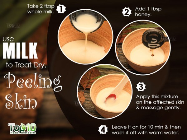 milk remedy for peeling skin