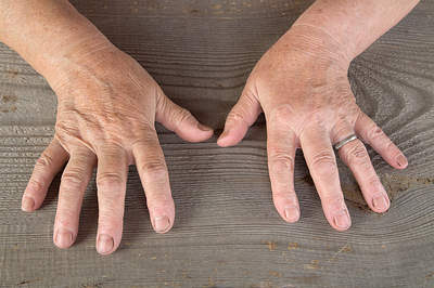 neglecting hands