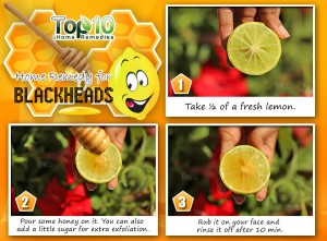 Lemon honey home remedy for blackheads