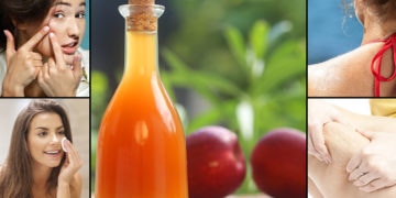 beauty benefits of apple cider vinegar