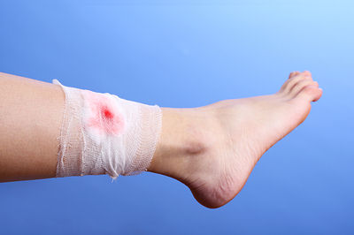 delays wound healing