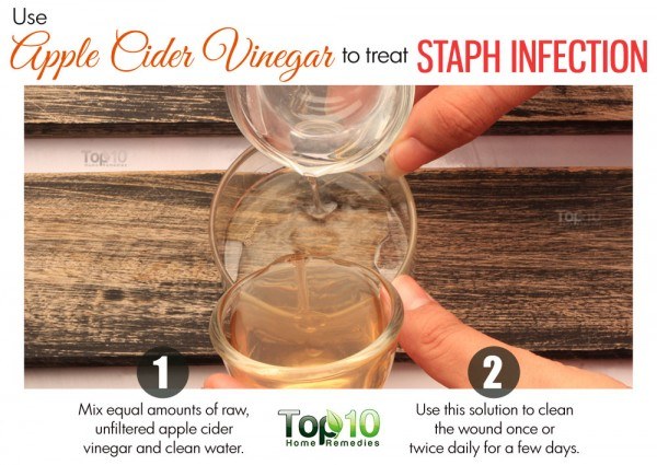 apple cider vinegar for staph infection