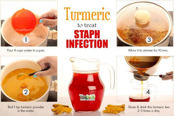 turmeric for staph infection