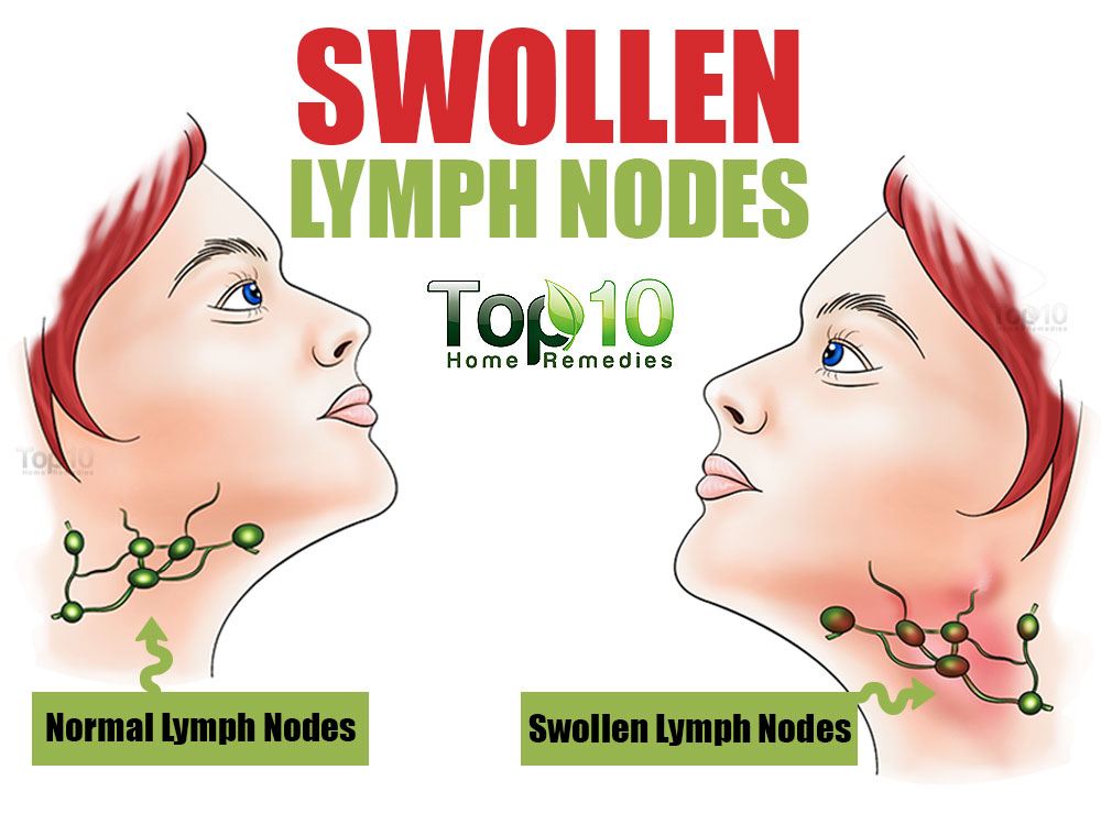 lymph nodes in back of neck location