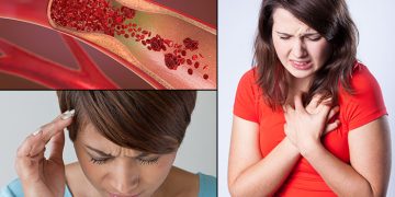 signs and symptoms of clogged arteries