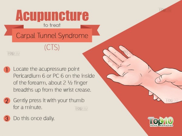Home Remedies for Carpal Tunnel Syndrome (CTS) | Top 10 Home Remedies