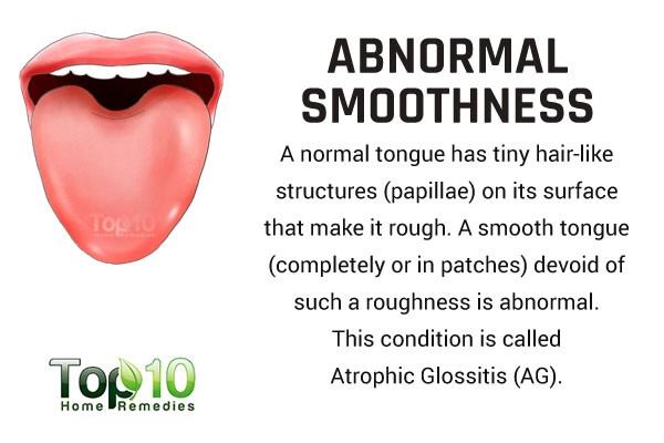 abnormal smoothness on tongue