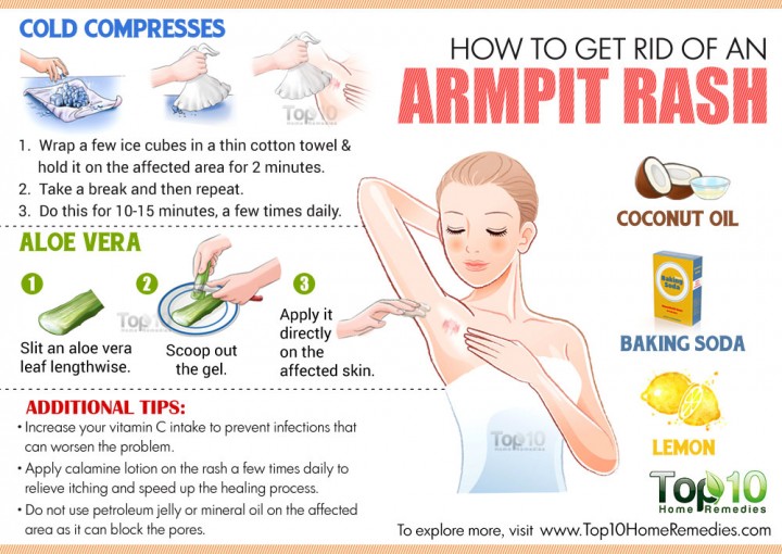 How to Get Rid of an Armpit Rash Reduce Irritation & Itching Top 10