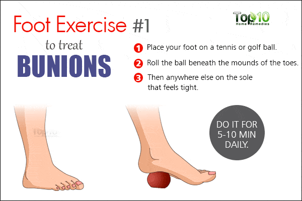 bunion foot exercise