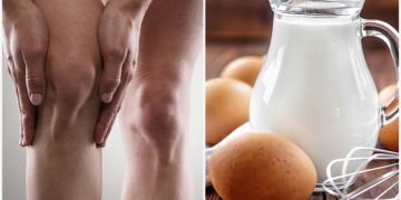 10 Foods to Avoid if You Have Joint Pain