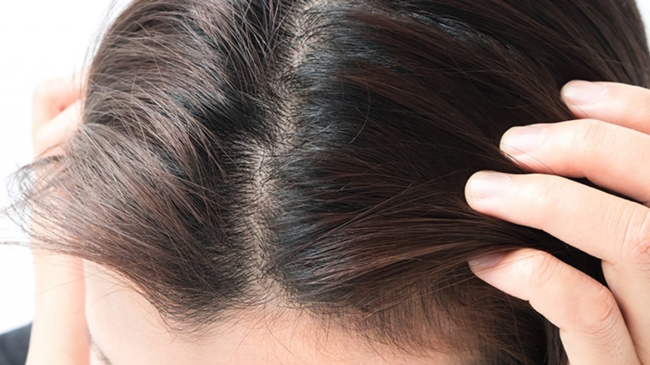 diy scalp acne treatment