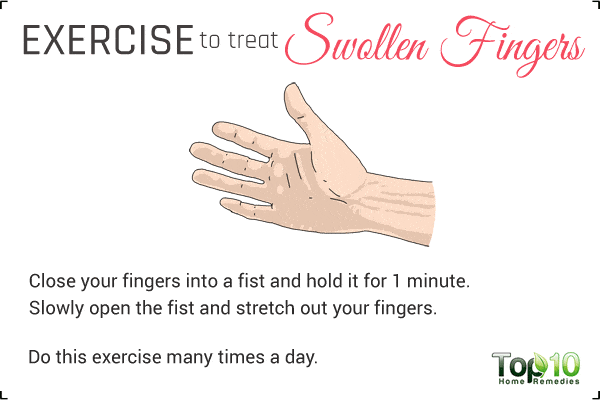 exercise for swollen fingers