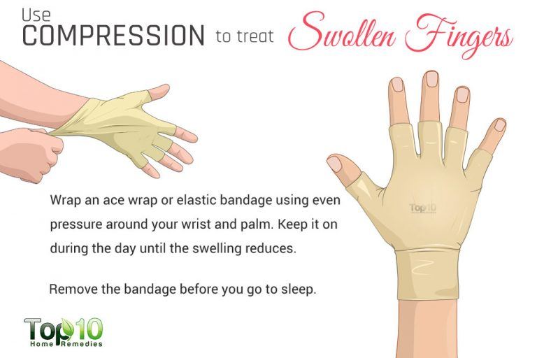 How to Treat Swollen Fingers Top 10 Home Remedies
