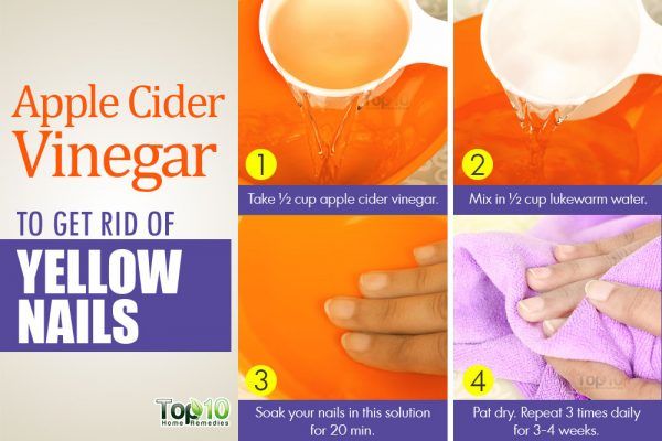 apple cider vinegar to get rid of yellow nails