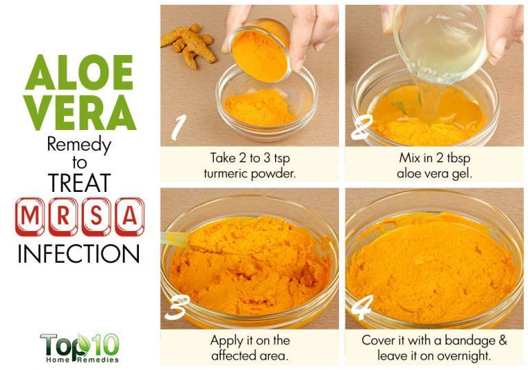How to Treat a MRSA Infection Naturally Top 10 Home Remedies
