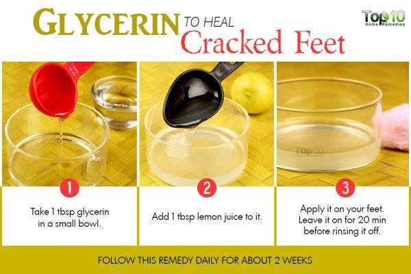 glycerin to heal cracked feet