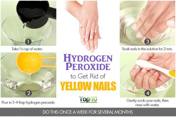 hydrogen peroxide to get tid of yellow nails