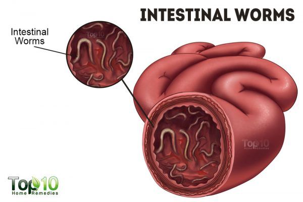 intestinal worms