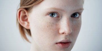 How to Get Rid of Blotchy and Uneven Skin
