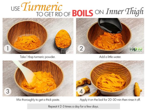 turmeric remedy to get rid of boils on inner thighs