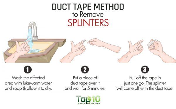 duct tape method to get rid of splinters