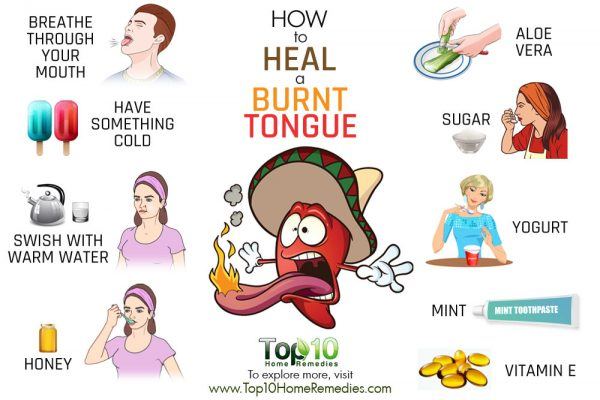how to heal a burnt tongue