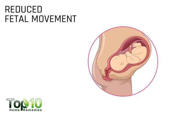 reduced fetal movement during pregnancy
