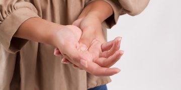 How to Deal with Trigger Finger