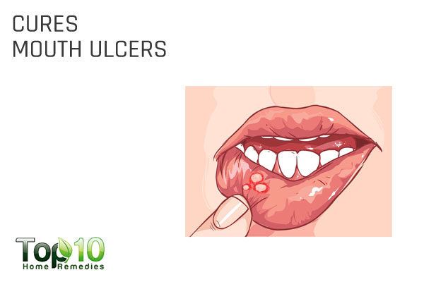 glycerin cures mouth ulcers