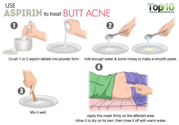bum acne treatment