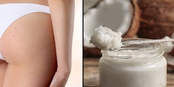 How to treat Butt acne Naturally