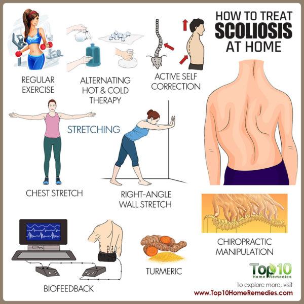 how to treat scoliosis