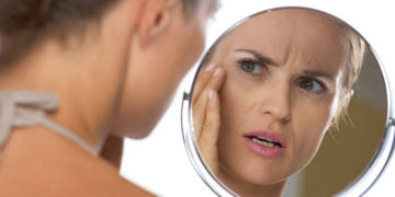 How to Get Rid of Broken Capillaries on Your Face