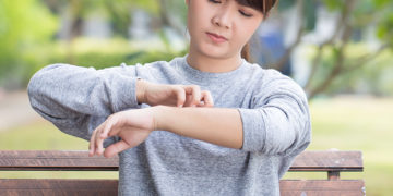 How to deal with Winter Eczema