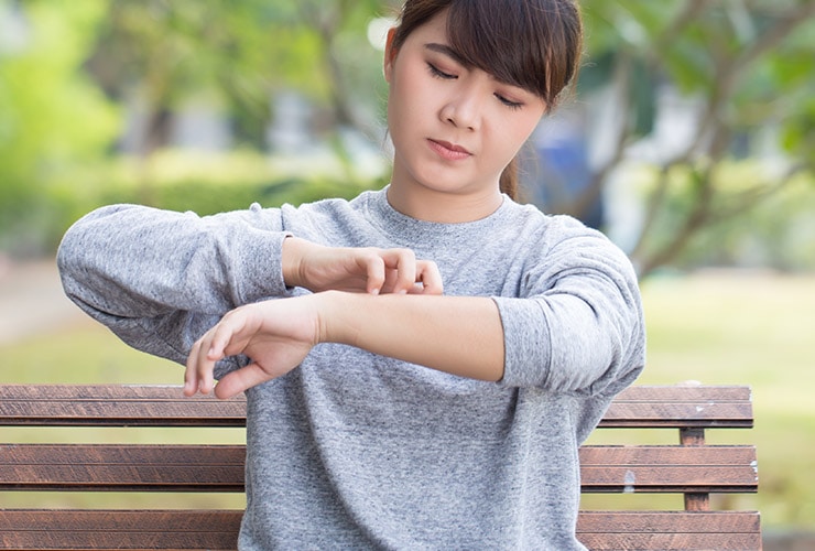 How to Deal with Winter Eczema Top 10 Home Remedies