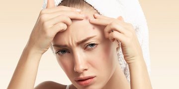 How to Get Rid of Bumps on Forehead