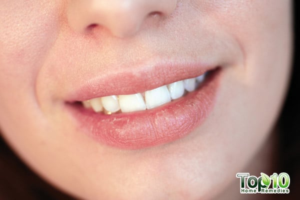 home remedies to treat smile lines