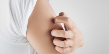 How to get rid of Bumps on Arms