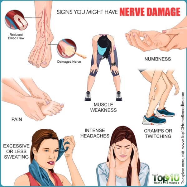 signs you may have nerve damage